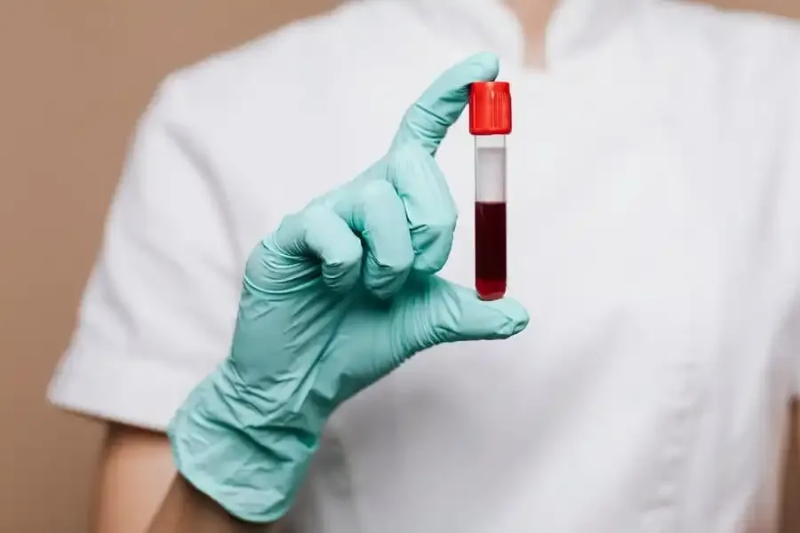 Blood Sample Collection