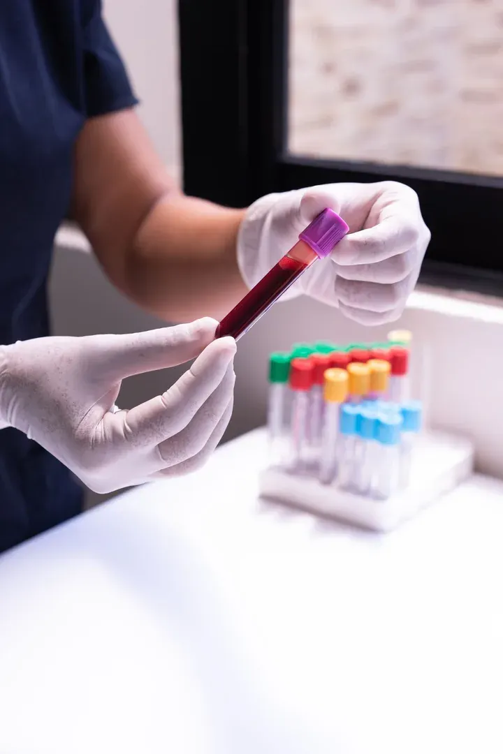 Blood sample vials for on-site diagnostic lab testing