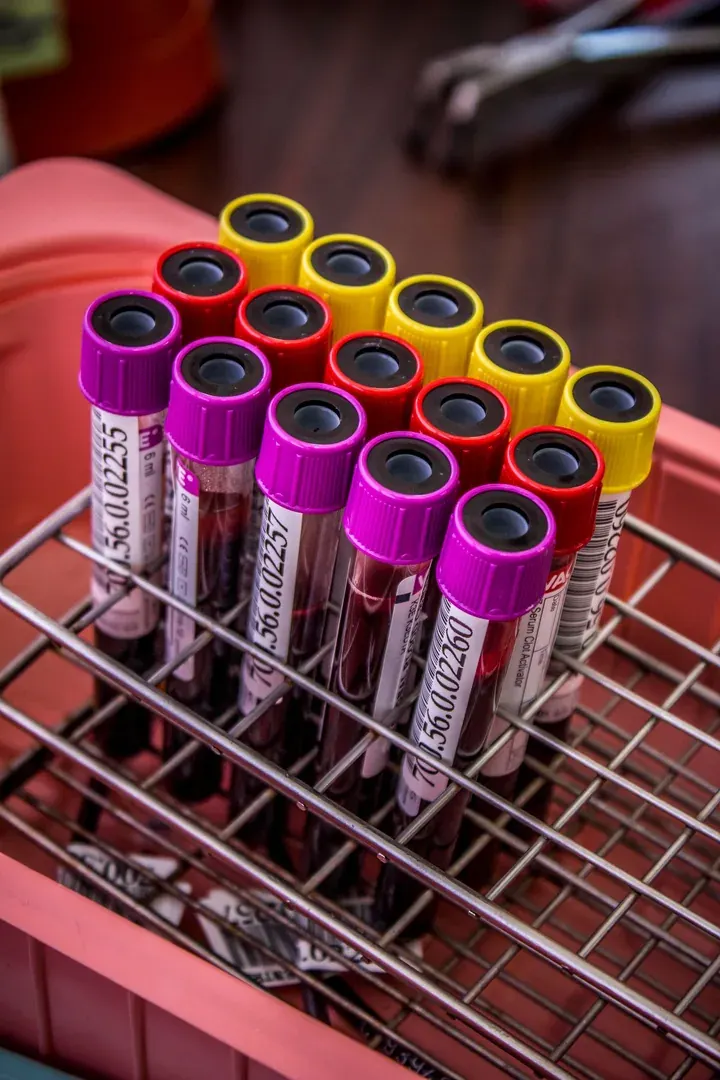On-site lab diagnostic testing at AyushPath clinic