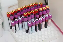 Blood sample vials for on-site diagnostic lab testing