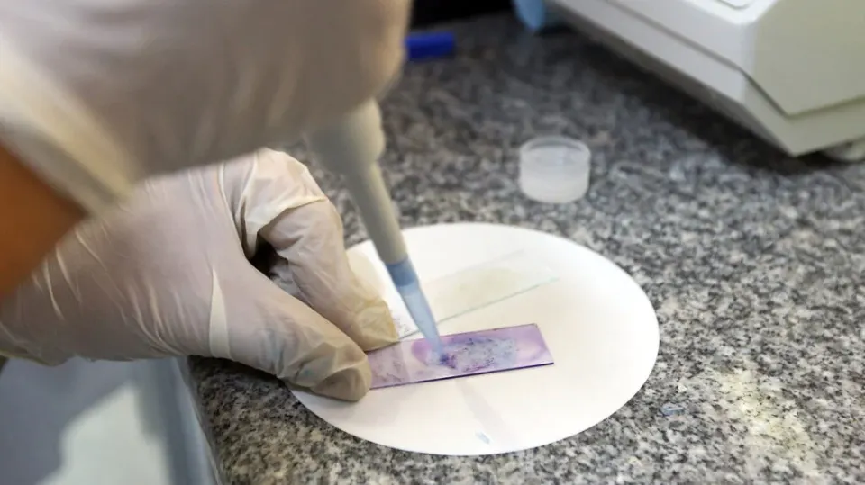 Biopsy and Histopathology Analysis